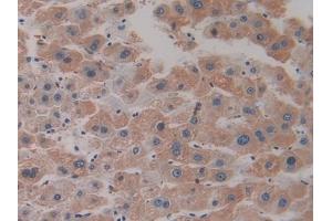 Detection of Hepc in Human Liver Tissue using Monoclonal Antibody to Hepcidin (Hepc)