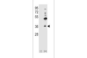 Western blot analysis of GJB4 using rabbit polyclonal GJB4 Antibody (H105.