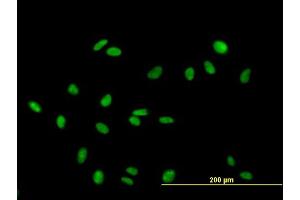 Immunofluorescence of purified MaxPab antibody to RAD18 on HeLa cell. (RAD18 anticorps  (AA 1-495))