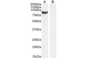 ABIN5539909 (1µg/ml) staining of Rat Testes lysate (A) + Peptide (B) (35µg protein in RIPA buffer). (STRA6 anticorps  (C-Term))