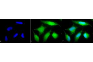 Immunocytochemistry/Immunofluorescence analysis using Rabbit Anti-Rab5 Polyclonal Antibody (ABIN361845 and ABIN361846).