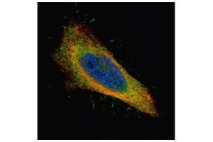 ICC/IF Image Confocal immunofluorescence analysis (Olympus FV10i) of paraformaldehyde-fixed HeLa, using Filamin B, antibody (Green) at 1:500 dilution.