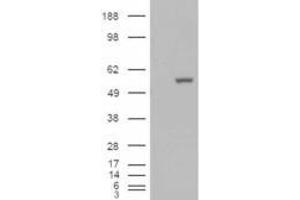 HEK293 overexpressing ALDH1A1 (ABIN5493687) and probed with ABIN184581 (mock transfection in first lane). (ALDH1A1 anticorps  (C-Term))