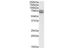 Image no. 1 for anti-Tripeptidyl Peptidase I (TPP1) (Internal Region) antibody (ABIN401515) (TPP1 anticorps  (Internal Region))