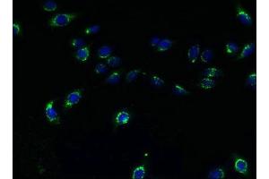 Immunofluorescent analysis of HepG2 cells using ABIN7173091 at dilution of 1:100 and Alexa Fluor 488-congugated AffiniPure Goat Anti-Rabbit IgG(H+L)