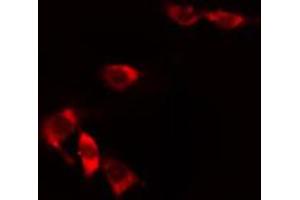 ABIN6274825 staining HuvEc cells by IF/ICC. (ALDH3B1 anticorps  (N-Term))