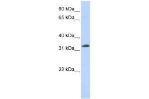 WB Suggested Anti-SIAH2 Antibody Titration: 0.