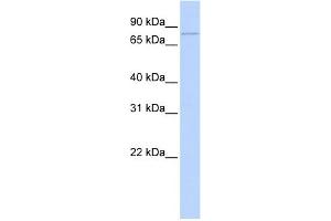 WB Suggested Anti-ZBTB39 Antibody Titration:  0. (ZBTB39 anticorps  (Middle Region))