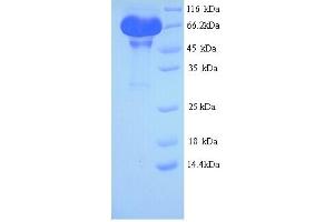 SDS-PAGE (SDS) image for Leucine-Rich Repeat Containing G Protein-Coupled Receptor 5 (LGR5) (AA 22-561) protein (His tag) (ABIN5713602)