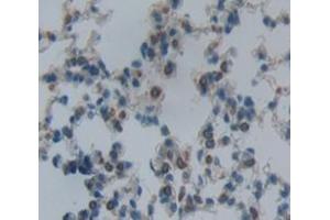 Used in DAB staining on fromalin fixed paraffin- embedded Kidney tissue (Oncostatin M Receptor anticorps  (AA 410-652))