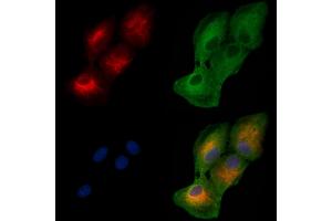 ABIN6256953 and ABIN6274870 staining  cells by IF/ICC.