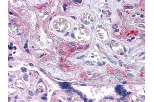 Immunohistochemical analysis of paraffin-embedded human Placenta tissues using ERN1 mouse mAb