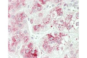 Formalin-fixed and paraffin-embedded H.