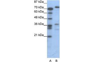 WB Suggested Anti-CREB3 Antibody Titration:  0. (CREB3 anticorps  (C-Term))