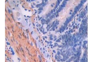 IHC-P analysis of Rat Intestine Tissue, with DAB staining. (Endoglin anticorps  (AA 26-136))