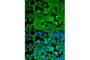 Immunofluorescence analysis of A549 cells using ASNS antibody. (Asparagine Synthetase anticorps)