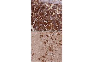 Immunohistochemical staining of human hippocampus with KARS polyclonal antibody  shows strong cytoplasmic positivity in neuronal cells at 1:50-1:200 dilution.