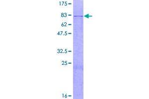 Image no. 1 for Galactosamine (N-Acetyl)-6-Sulfate Sulfatase (GALNS) (AA 1-522) protein (GST tag) (ABIN1354723)