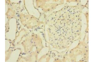 Immunohistochemistry of paraffin-embedded human kidney tissue using ABIN7176509 at dilution of 1:100