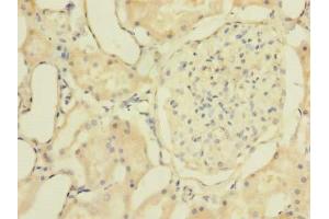 Immunohistochemistry of paraffin-embedded human kidney tissue using ABIN7176509 at dilution of 1:100 (ZNF77 anticorps  (AA 51-369))