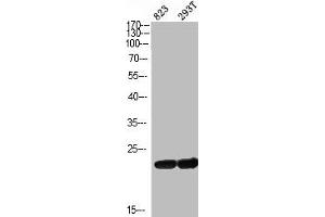 Western Blot analysis of 823 293T cells using ASC Polyclonal Antibody