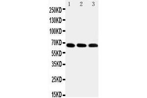 Anti-IRAKM antibody,  Western blotting Lane 1: HELA Cell Lysate Lane 2: JURKAT Cell Lysate Lane 3: HUT102 Cell Lysate