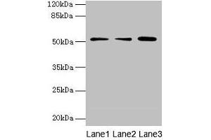 Western blot All lanes: ACSBG2 antibody at 4 μg/mL Lane 1: A431 whole cell lysate Lane 2: K562 whole cell lysate Lane 3: A549 whole cell lysate Secondary Goat polyclonal to rabbit IgG at 1/10000 dilution Predicted band size: 75, 69, 54, 52 kDa Observed band size: 52 kDa (ACSBG2 anticorps  (AA 301-600))