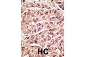 Immunohistochemistry (IHC) image for anti-Small Ubiquitin Related Modifier 4 (SUMO4) (M55V) antibody (ABIN2996873)