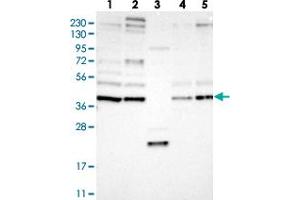 Western blot analysis of Lane 1: RT-4, Lane 2: U-251 MG, Lane 3: Human Plasma, Lane 4: Liver, Lane 5: Tonsil with FRYL polyclonal antibody  at 1:250-1:500 dilution. (FRY-Like anticorps)