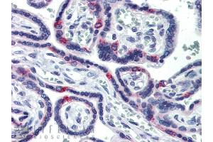 SIN3A antibody was used for immunohistochemistry at a concentration of 5.