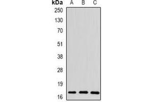 Western blot analysis of Spot 14 expression in mouse liver (A), rat brain (B), rat heart (C) whole cell lysates. (THRSP anticorps)