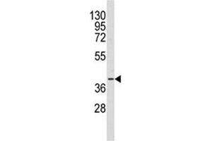 Western blot analysis of AKR1A1 antibody and Y79 lysate (AKR1A1 anticorps  (AA 293-325))
