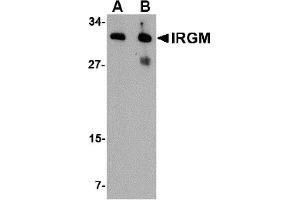 WB Image for AP22614PU-N Western blot analysis of IRGM in human brain lysate with IRGM antibody at (A) 1 and (B) 2 µg/ml. (IRGM anticorps  (Center))