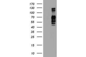 Western Blotting (WB) image for anti-Golgi Membrane Protein 1 (GOLM1) antibody (ABIN1498493) (GOLM1 anticorps)