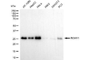 Western blotting analysis using RCHY1 antibody (ABIN7800239).