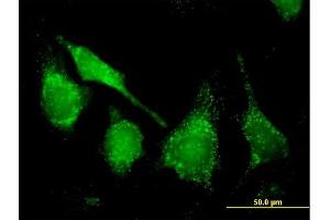 Immunofluorescence of purified MaxPab antibody to CAT on HeLa cell. (Catalase anticorps  (AA 1-527))