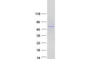 Validation with Western Blot