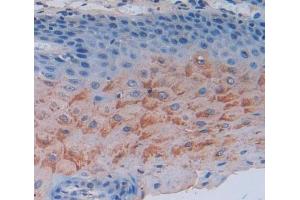Used in DAB staining on fromalin fixed paraffin- embedded esophagus tissue (SCEL anticorps  (AA 519-685))
