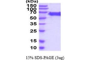 SDS-PAGE (SDS) image for Dopachrome Tautomerase (DCT) (AA 24-472) protein (His tag) (ABIN5854719) (DCT Protein (AA 24-472) (His tag))