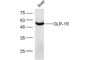 Mouse liver lysates probed with Anti-GLP-1R Polyclonal Antibody, Unconjugated  at 1:5000 for 90 min at 37˚C. (GLP1R anticorps  (AA 101-200))
