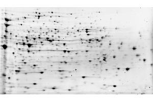 2D Oriole Stain of E. (HCP Protéine)