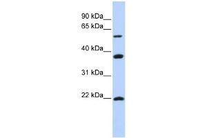 WB Suggested Anti-MYLIP Antibody Titration:  0. (MYLIP anticorps  (Middle Region))