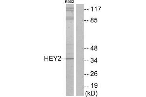 Western Blotting (WB) image for anti-Hairy/enhancer-of-Split Related with YRPW Motif 2 (HEY2) (Internal Region) antibody (ABIN1850038) (HEY2 anticorps  (Internal Region))