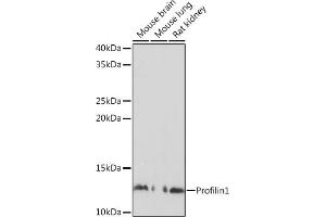 Western blot analysis of extracts of various cell lines, using Profilin1 Polyclonal Antibody (ABIN3021598, ABIN3021599, ABIN3021600 and ABIN6215334) at 1:500 dilution. (PFN1 anticorps  (AA 1-140))