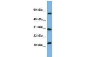 Image no. 1 for anti-Signal Recognition Particle 19kDa (SRP19) (C-Term) antibody (ABIN6741676) (SRP19 anticorps  (C-Term))
