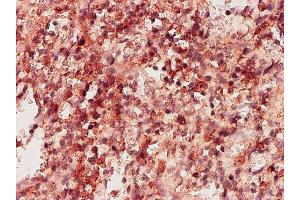 Immunoperoxidase of monoclonal antibody to KHK on formalin-fixed paraffin-embedded human spleen tissue.