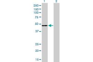 Western Blot analysis of CFH expression in transfected 293T cell line by CFH MaxPab polyclonal antibody.