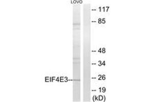 Western blot analysis of extracts from LOVO cells, using EIF4E3 Antibody.