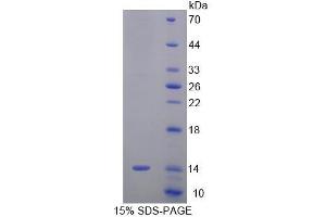 SDS-PAGE analysis of Mouse SRP9 Protein. (SRP9 Protéine)