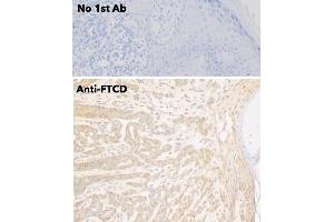 Immunohistochemistry (IHC) image for anti-Formiminotransferase Cyclodeaminase (FTCD) (N-Term) antibody (ABIN6254252)